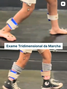 exame marcha 3d